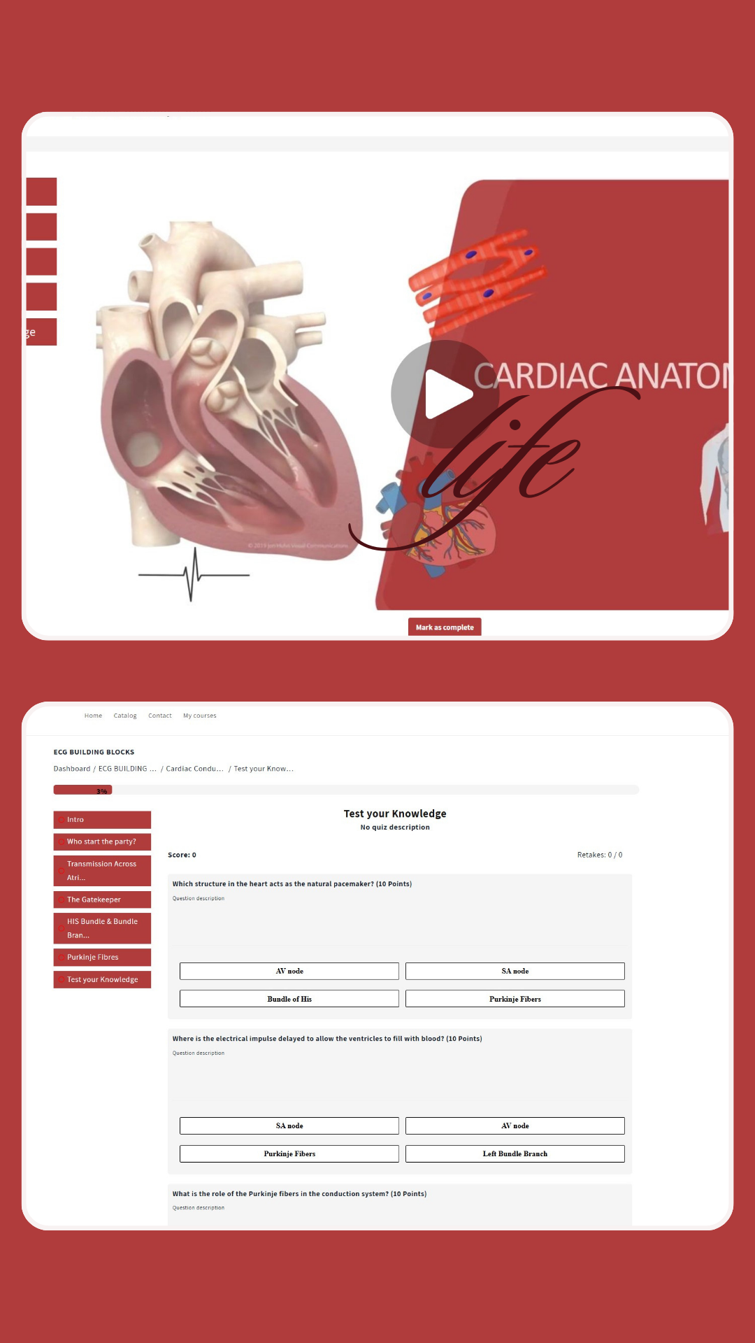 ECG Building Blocks - Online Course