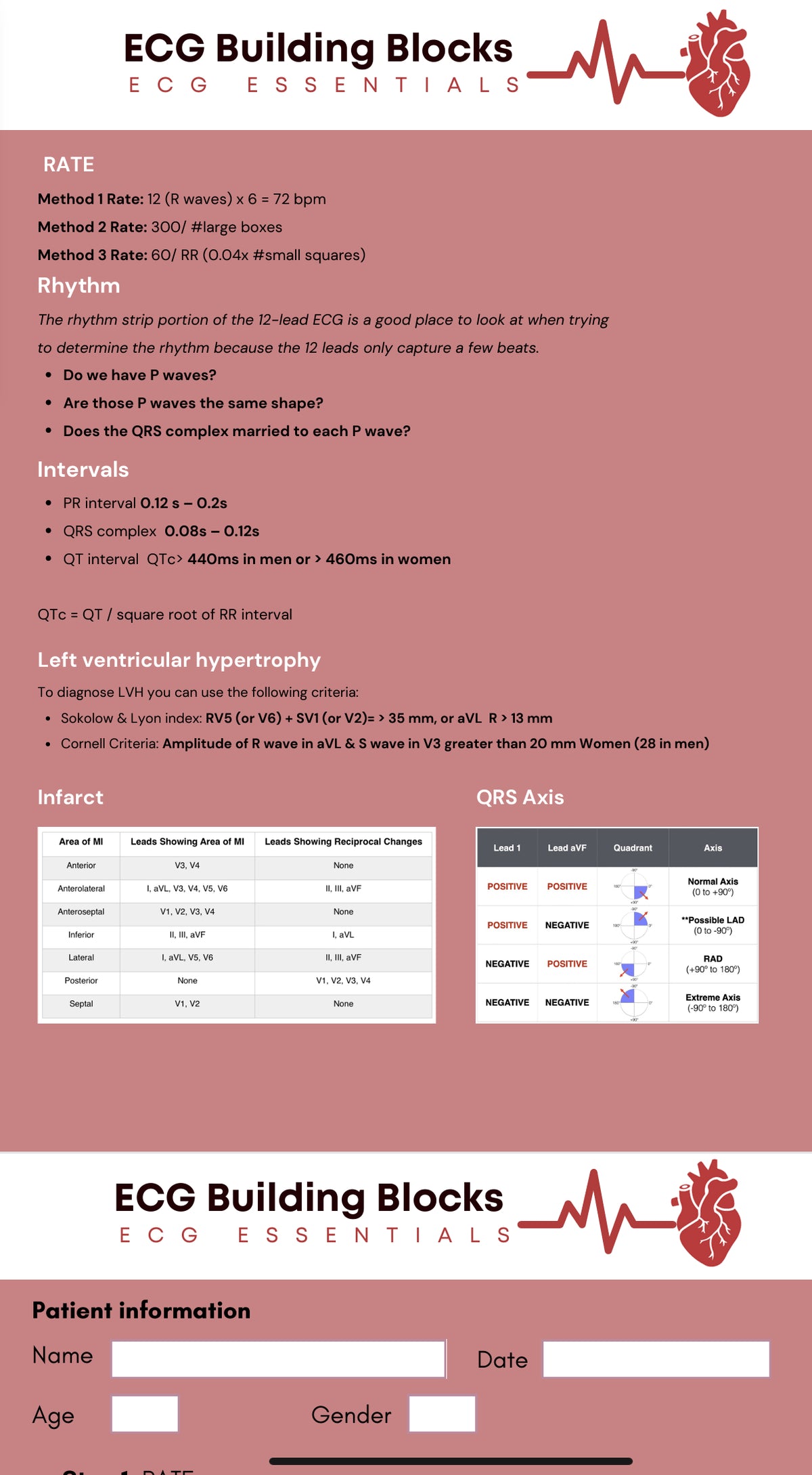 Example Ecg Blocks Printable Ecg Solution: Practice Strips Of Ecg - MedienHome.de
